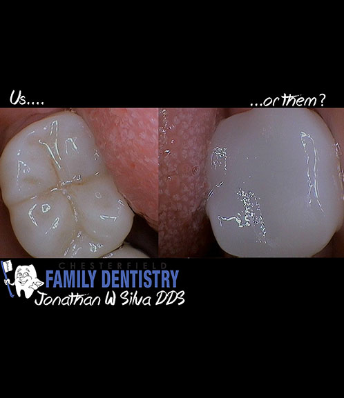 Picture of our dental work