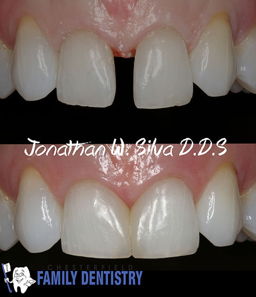 Picture of our cosmetic dental work