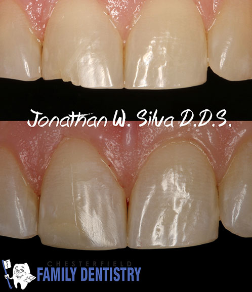 Picture of our past restorative dental work